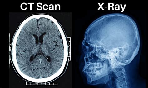 ct scans are very similar to x-rays